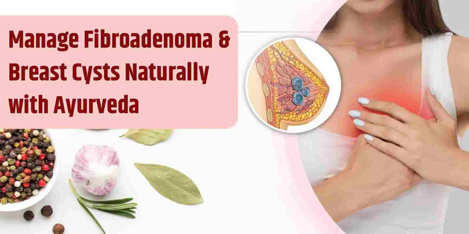 Manage Fibroadenoma & Breast Cysts Naturally with Ayurveda